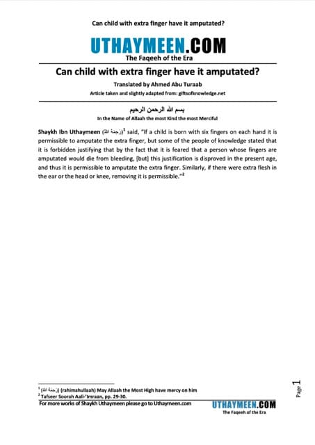 Can child with extra finger have it amputated